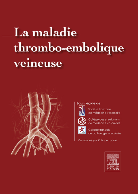 Cover image for book La maladie thrombo-embolique veineuse