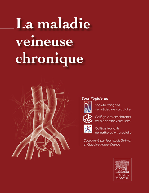 Cover image for book La maladie veineuse chronique