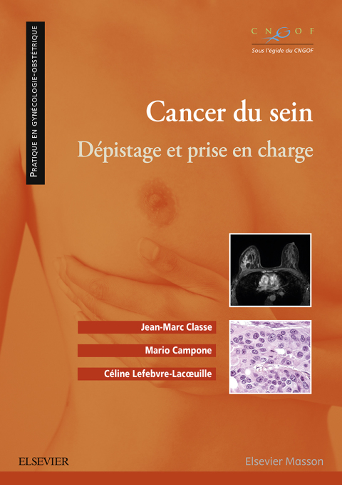 Cover image for book Cancer du sein