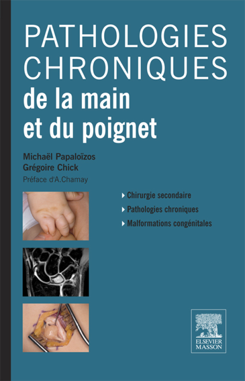 Cover image for book Pathologies chroniques de la main et du poignet