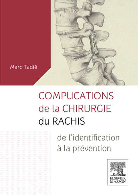 Cover image for book Complications de la chirurgie du rachis