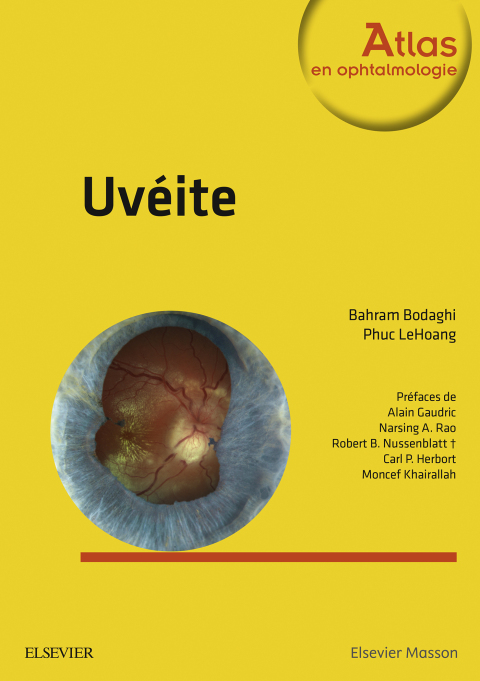 Cover image for book Uvéite