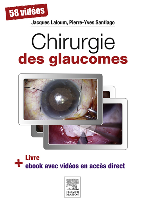 Cover image for book Chirurgie des glaucomes
