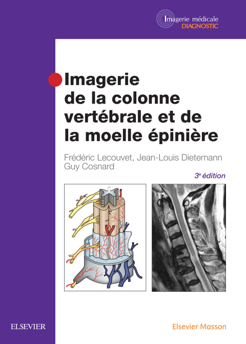 Cover image for book Imagerie de la colonne vertébrale et de la moelle épinière