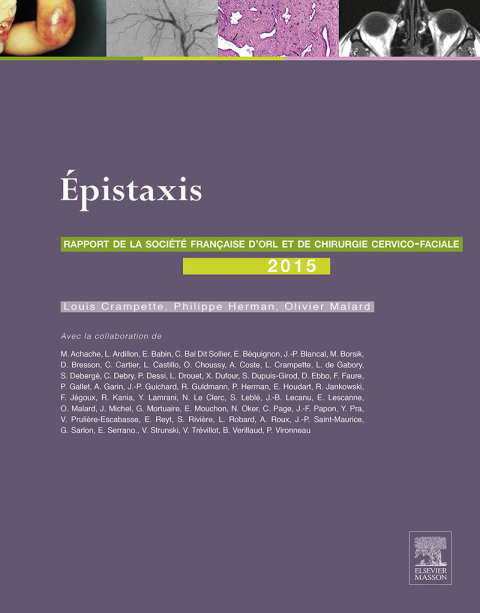 Cover image for book Les épistaxis