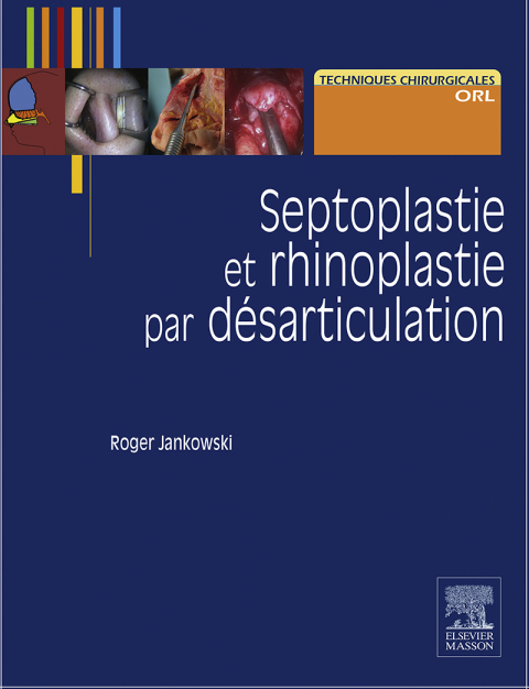 Cover image for book Septoplastie et rhinoplastie par désarticulation