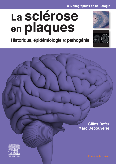 Cover image for book La sclérose en plaques - Historique, épidémiologie et pathogénie