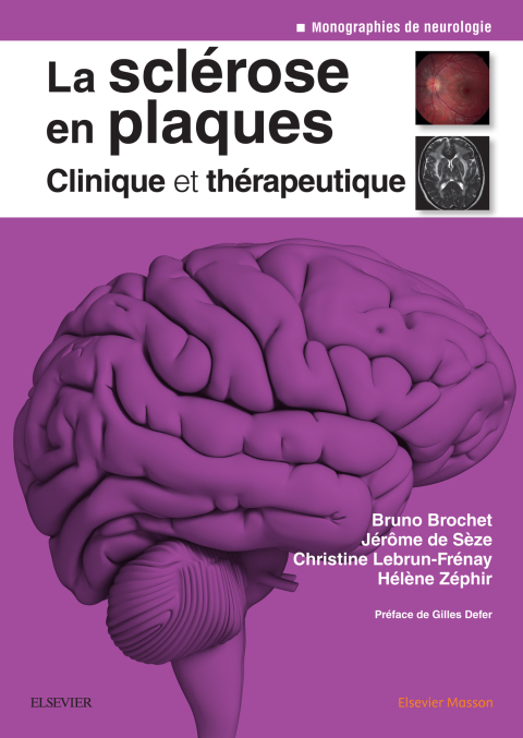 Cover image for book La sclérose en plaques - Clinique et thérapeutique