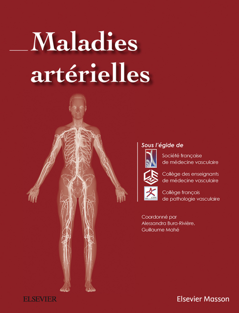 Cover image for book Maladies artérielles