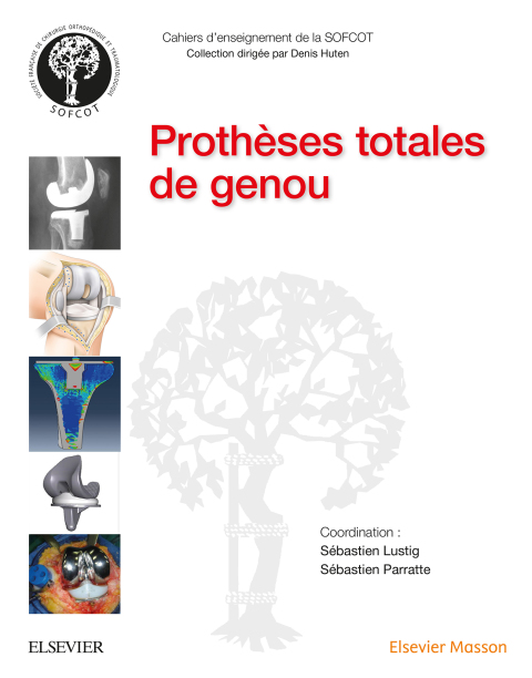 Cover image for book Prothèses totales de genou