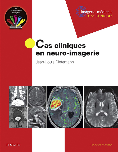 Cover image for book Cas cliniques en neuro-imagerie