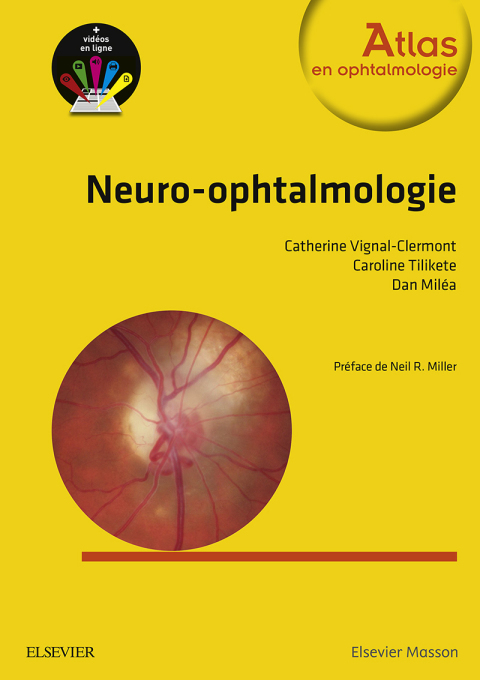 Cover image for book Neuro-ophtalmologie