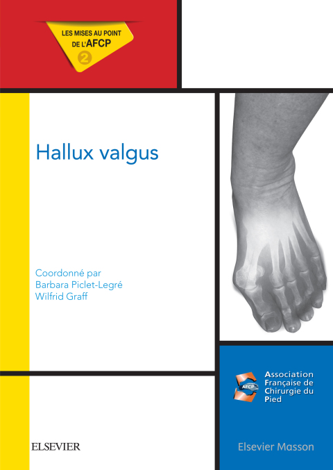 Cover image for book Hallux valgus