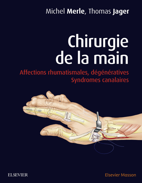 Cover image for book Chirurgie de la main