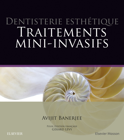 Cover image for book Dentisterie esthétique : traitements mini-invasifs