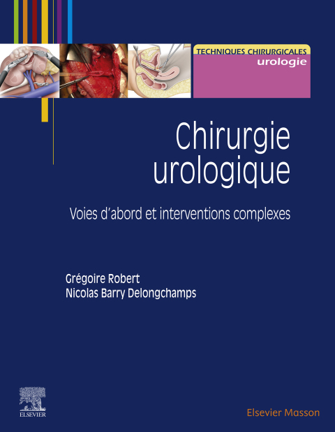 Chirurgie urologique 
