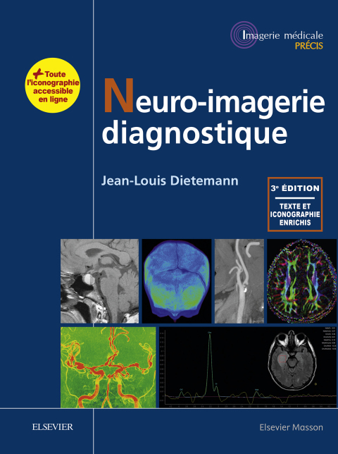 Cover image for book Neuro-imagerie diagnostique