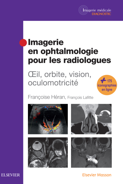 Cover image for book Imagerie en ophtalmologie pour les radiologues