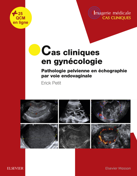 Cover image for book Cas cliniques en imagerie : gynécologie
