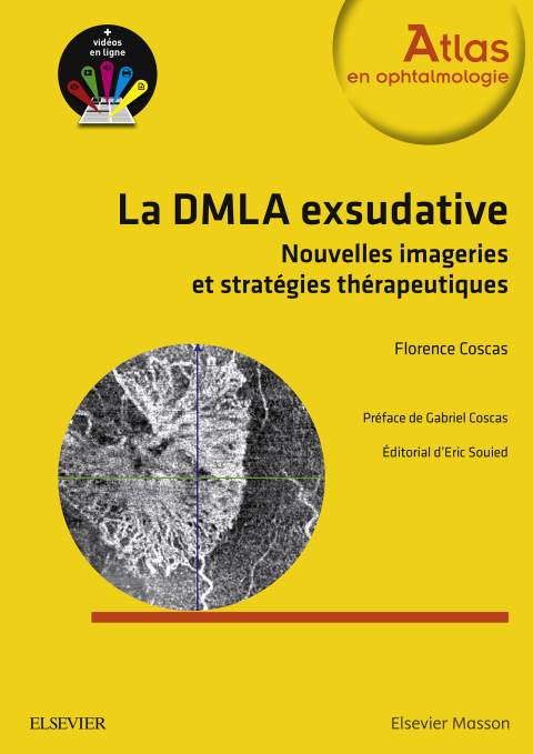 Cover image for book La DMLA exsudative