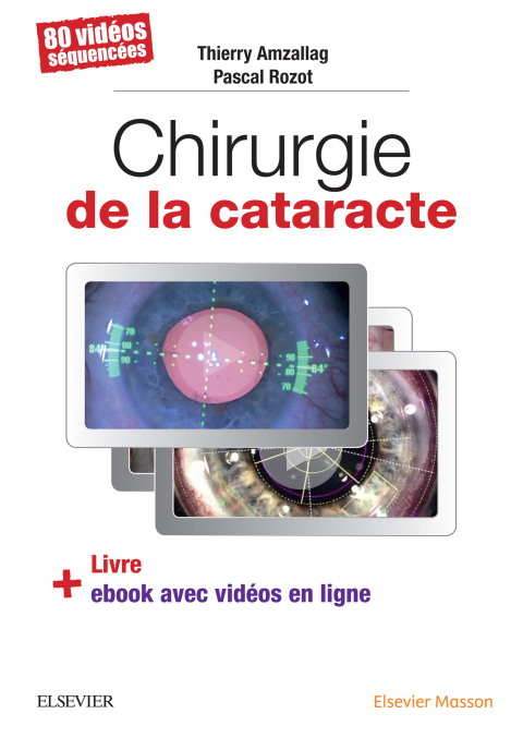 Cover image for book Chirurgie de la cataracte