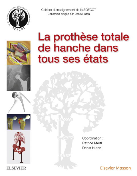 Cover image for book La prothèse totale de hanche dans tous ses états