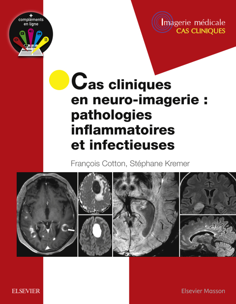 Cover image for book Cas cliniques en neuro-imagerie : pathologies inflammatoires et infectieuses