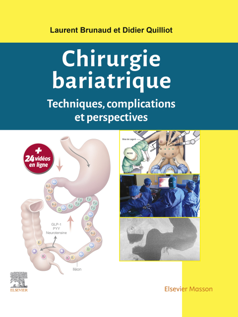 Cover image for book Chirurgie bariatrique