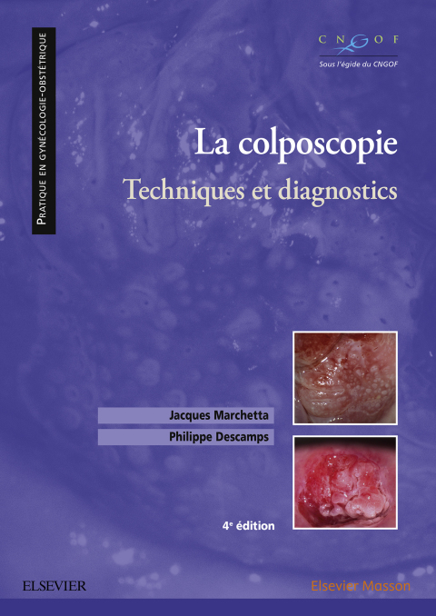 Cover image for book La colposcopie