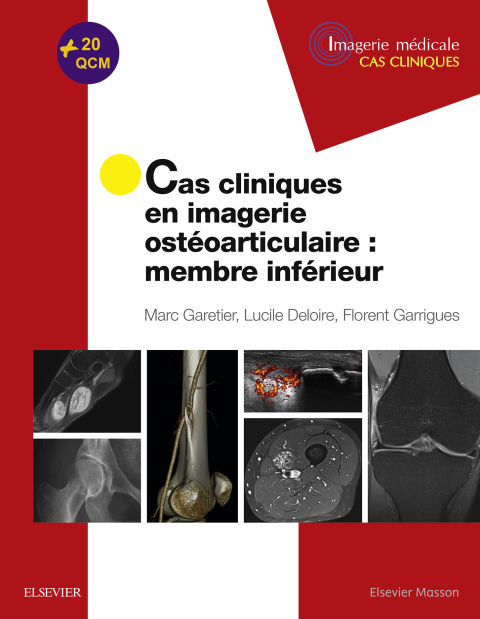 Cover image for book Cas cliniques en imagerie ostéoarticulaire : membre inférieur
