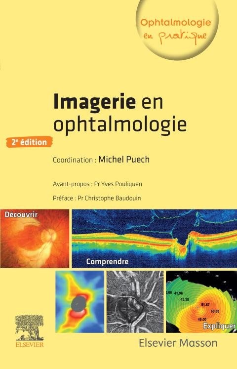 Cover image for book Imagerie en ophtalmologie
