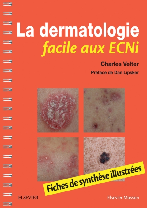 Cover image for book La dermatologie facile aux ECNi