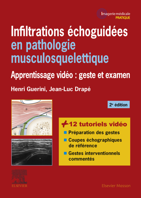 Cover image for book Infiltrations échoguidées en pathologie musculosquelettique