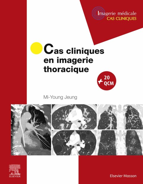 Cover image for book Cas cliniques en imagerie thoracique