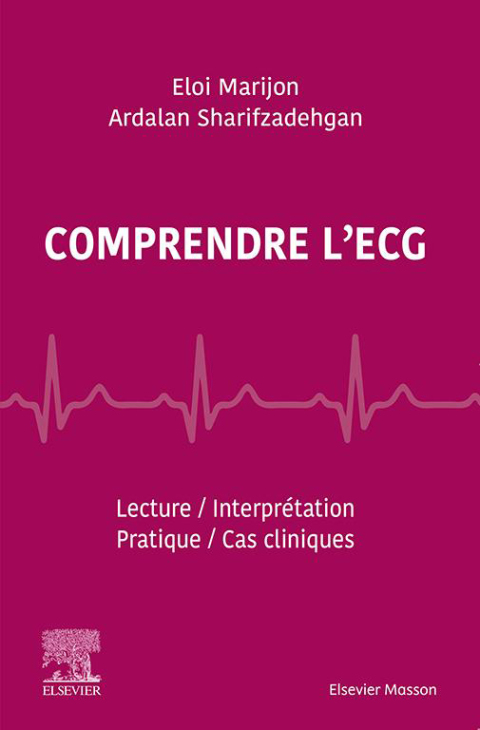 Cover image for book Comprendre l'ECG