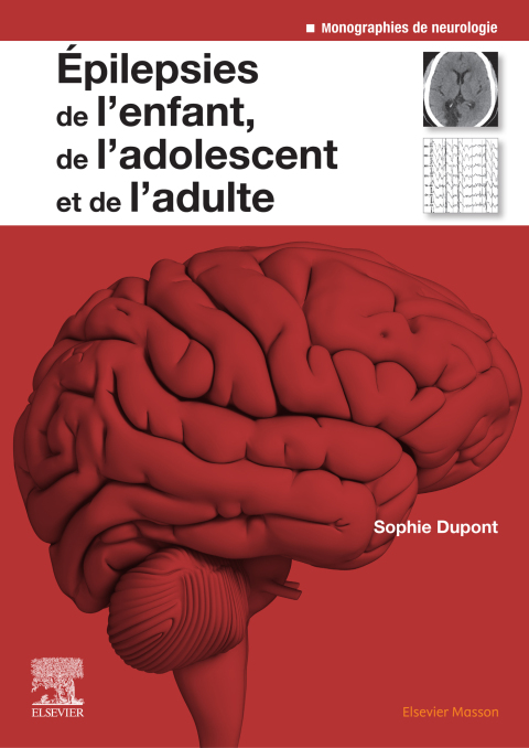 Cover image for book Epilepsies de l'enfant, de l'adolescent et de l'adulte