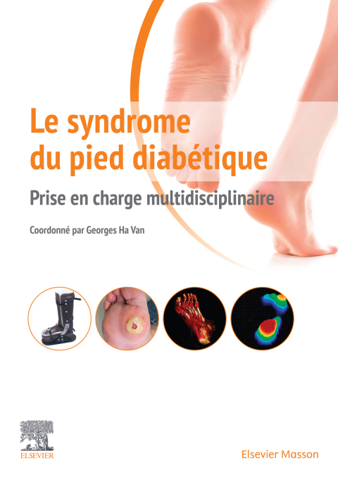 Cover image for book Le syndrome du pied diabétique