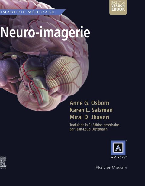 Neuro-imagerie 