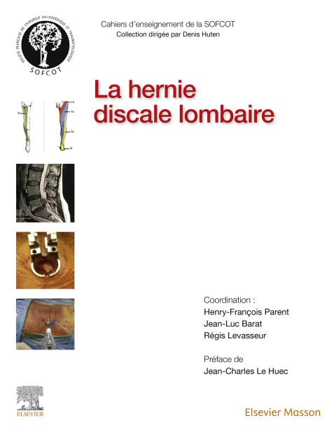 Cover image for book La hernie discale lombaire