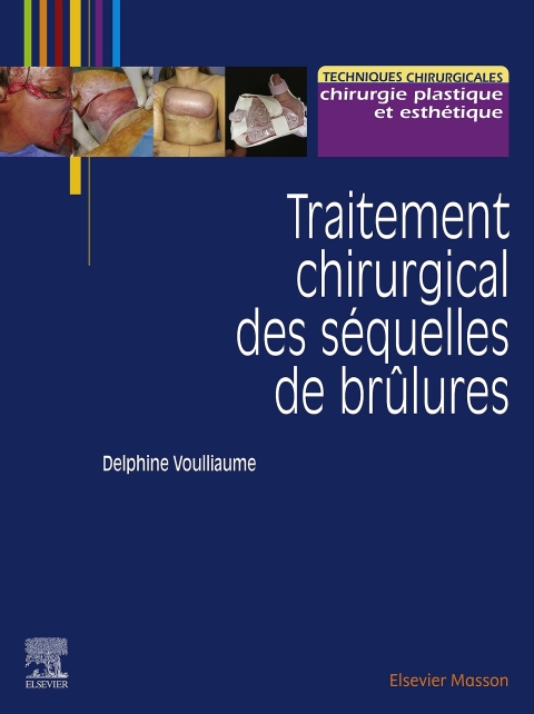 Cover image for book Traitement chirurgical des séquelles de brûlures