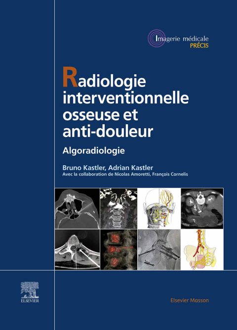 Cover image for book Radiologie Interventionnelle osseuse et anti-douleur