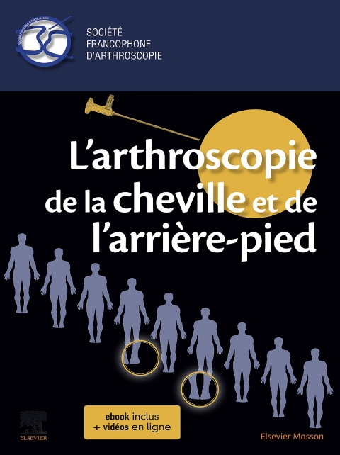 L'arthroscopie de la cheville et de l'arrière-pied 