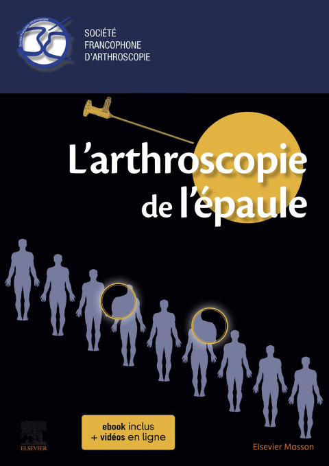 Cover image for book L'arthroscopie de l'épaule