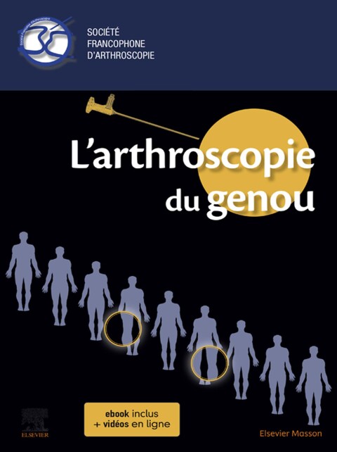 Cover image for book L'arthroscopie du genou