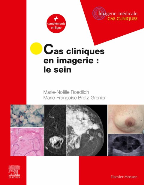 Cover image for book Cas cliniques en imagerie : le sein