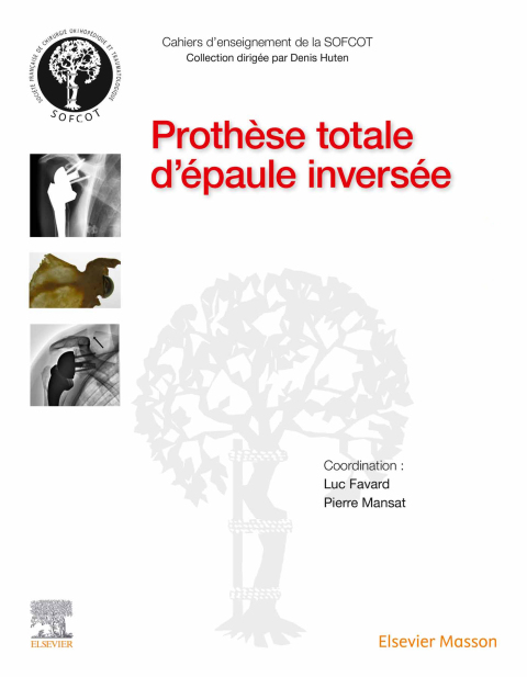 Cover image for book Prothèse totale d'épaule inversée