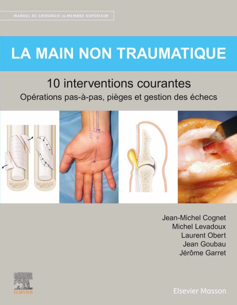 Cover image for book La main non traumatique 10 interventions courantes