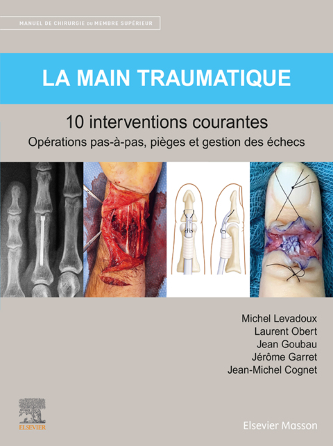 Cover image for book La main traumatique 10 interventions courantes