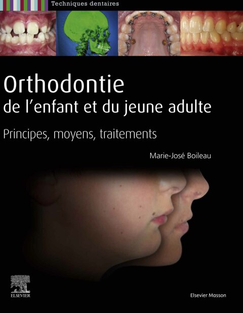 Cover image for book Orthodontie de l'enfant et du jeune adulte