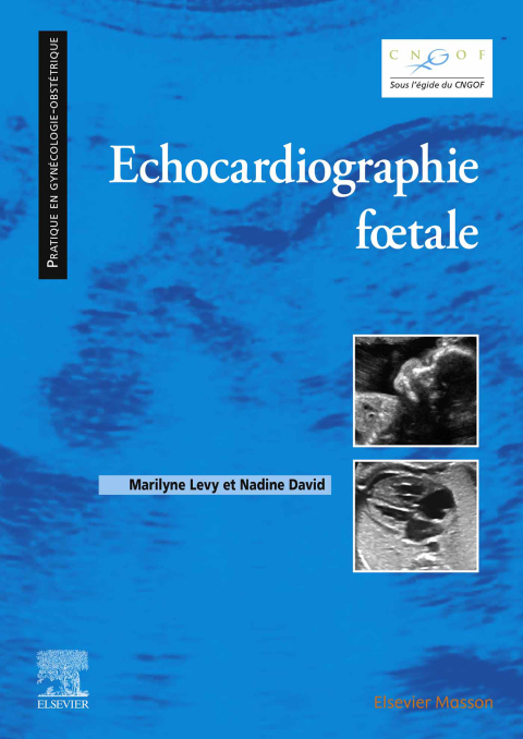 Cover image for book Echocardiographie fœtale